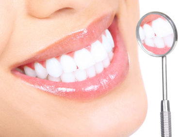 Naturalne metody wybielania zębów