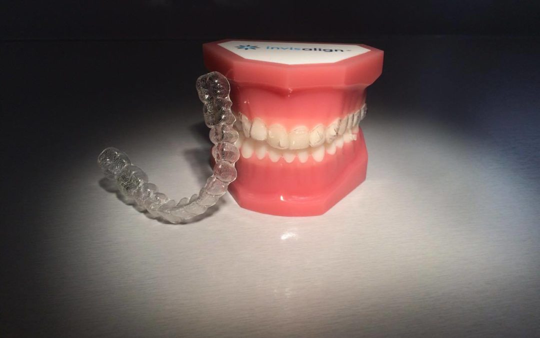 Niewidoczne leczenie ortodontyczne – aparat Invisalign
